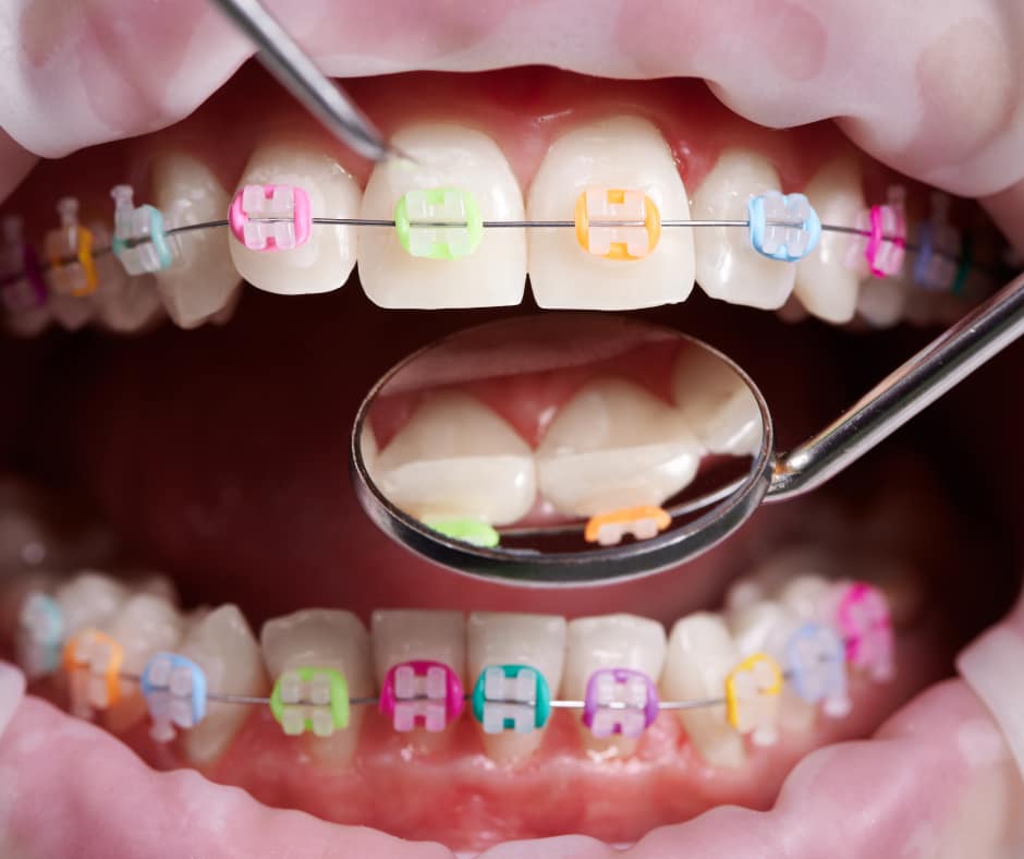 Central Illinois - Orthodontic - Sale of Practice — Central Illinois, IL